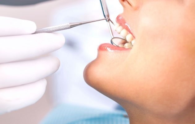 Limpeza dos dentes benefícios da profilaxia bucal