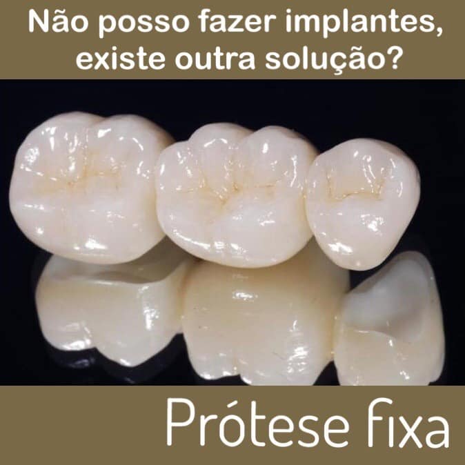 nao poso fazer implantes existe outra solucao