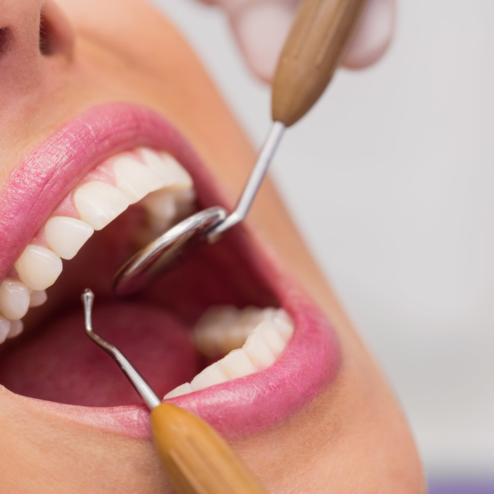cropped dentist examining female patient teeth scaled 1 - Front Page